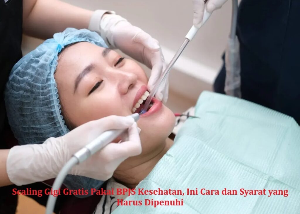 Scaling Gigi Gratis Pakai BPJS Kesehatan, Ini Cara dan Syarat yang Harus Dipenuhi
