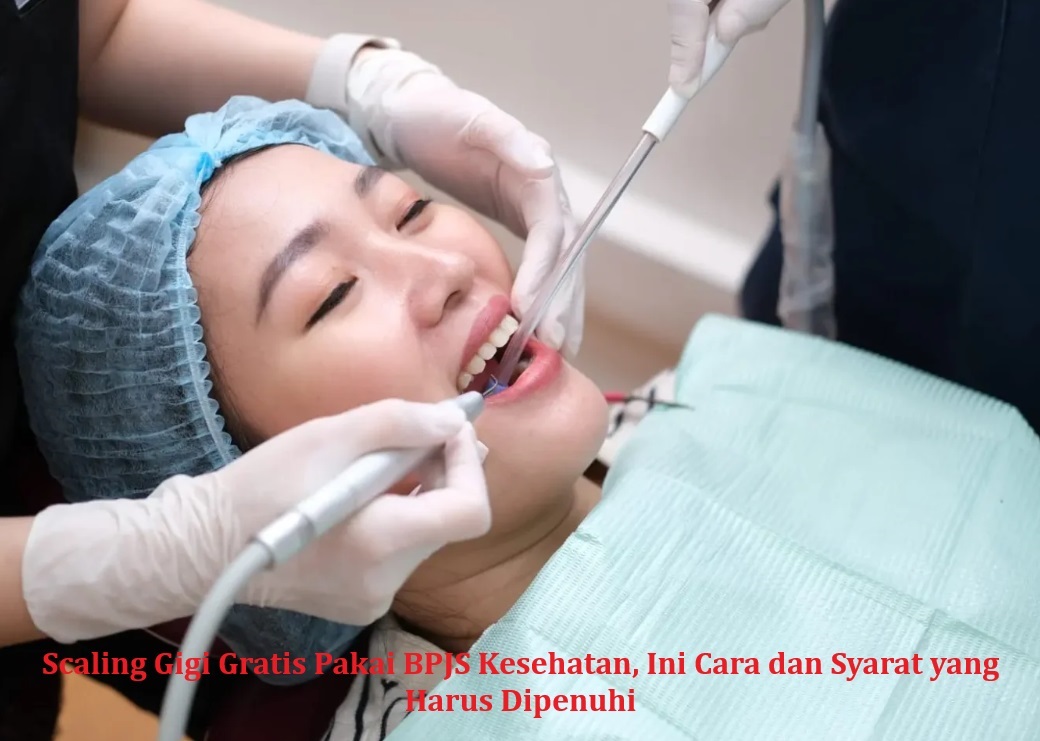 Scaling Gigi Gratis Pakai BPJS Kesehatan, Ini Cara dan Syarat yang Harus Dipenuhi